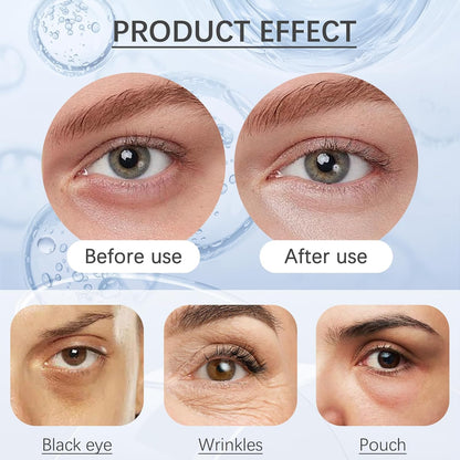 Temporary Eye Tightener Instant Eye Cream--The 90 Second Eyebag Fix