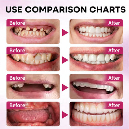 🦷 LOVILDS FirmHold Adhesive – No Slip, Lasts 4 Days🦷