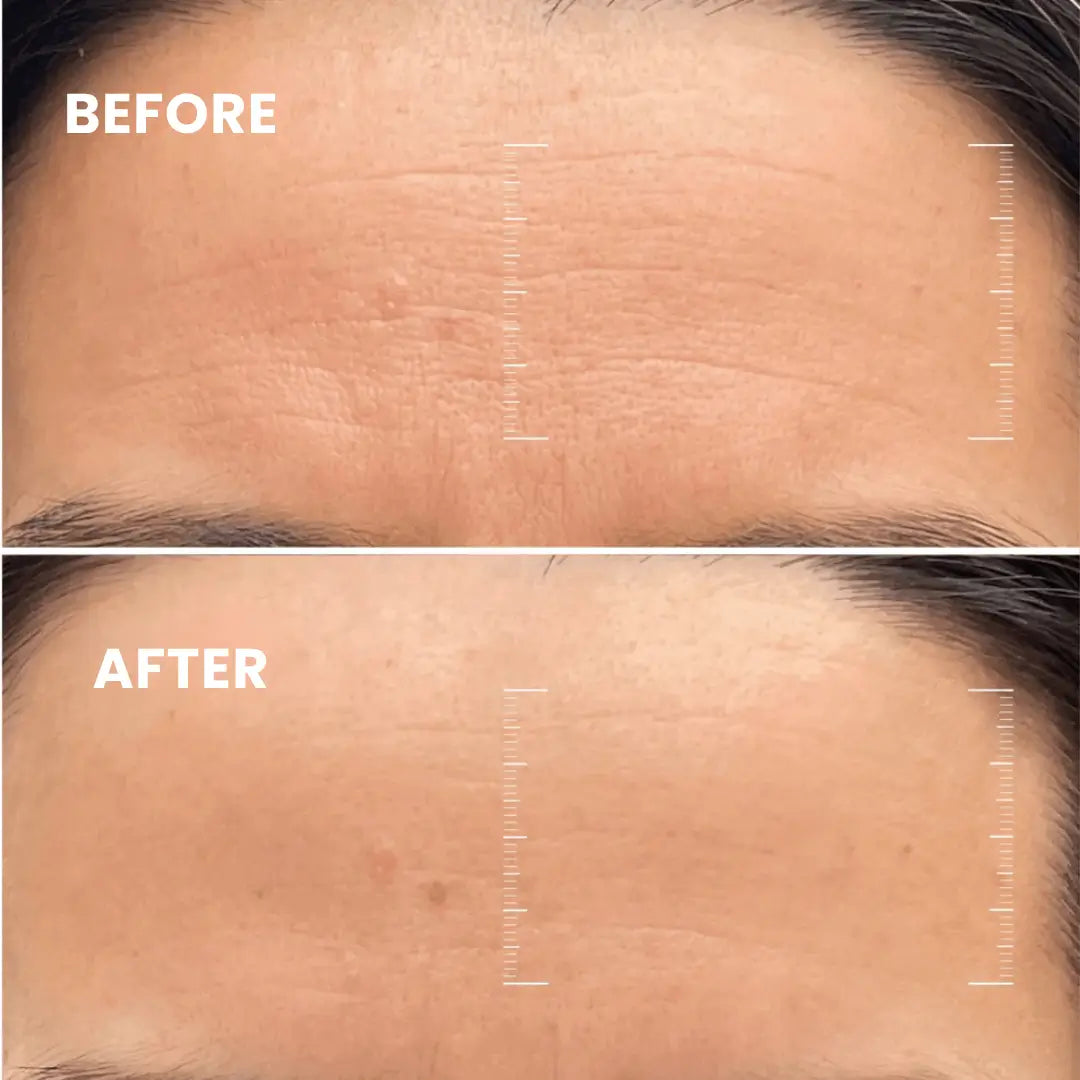Collagen-Boosting Night Mask | Visibly younger skin in just 7 days!