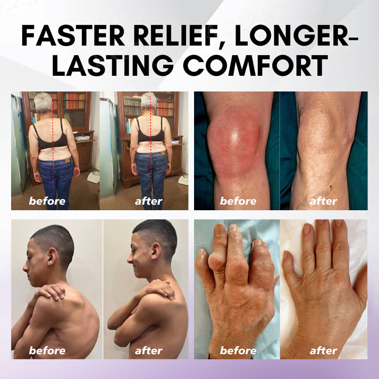 ⏰Black Friday Limited-Time Special Offer: BUY 1 GET 1 FREE🔥 Turmeric & Emu Oil Arthritis Soothing Pain Relief Massage Gel 👨‍⚕️ American Osteopathic Association (AOA) Approved