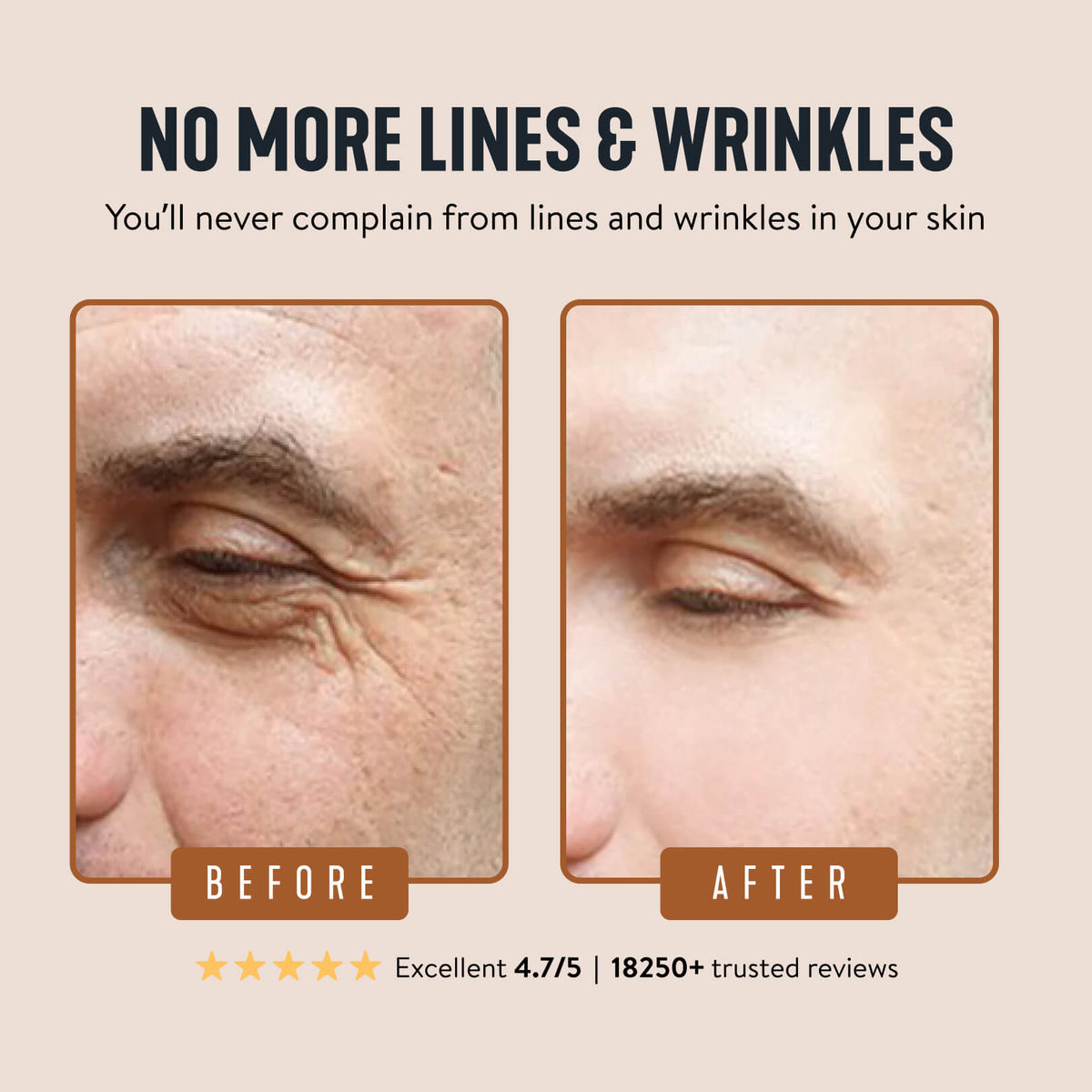 Skin Before and After