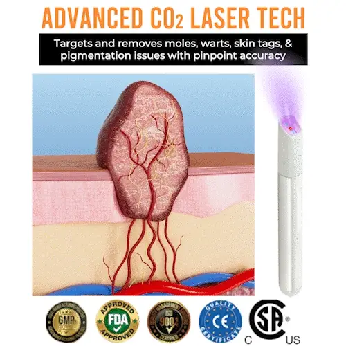 💞All-in-One CO₂ Laser Eraser Pen | Removes Moles, Warts, Skin Flaws & Pigmentation