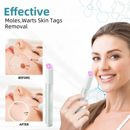 💞All-in-One CO₂ Laser Eraser Pen | Removes Moles, Warts, Skin Flaws & Pigmentation