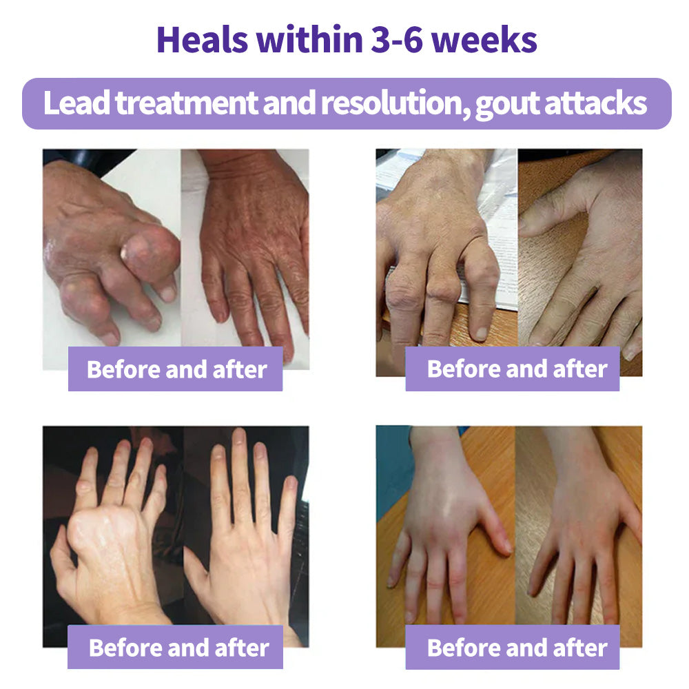 ⏰Black Friday Limited-Time Special Offer: BUY 1 GET 1 FREE🔥SEAGRIL™ Turmeric & Emu Oil Arthritis Soothing Pain Relief Massage Gel 👨‍⚕️ American Osteopathic Association (AOA) Approved