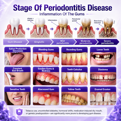 Gingivitis Periodontal Treatment Toothpaste