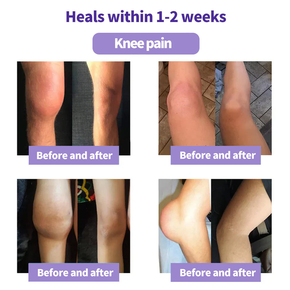 ⏰Black Friday Limited-Time Special Offer: BUY 1 GET 1 FREE🔥 Turmeric & Emu Oil Arthritis Soothing Pain Relief Massage Gel 👨‍⚕️ American Osteopathic Association (AOA) Approved