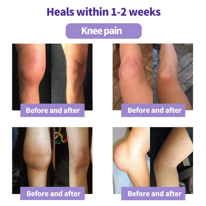 ⏰Black Friday Limited-Time Special Offer: BUY 1 GET 1 FREE🔥SEAGRIL™ Turmeric & Emu Oil Arthritis Soothing Pain Relief Massage Gel 👨‍⚕️ American Osteopathic Association (AOA) Approved