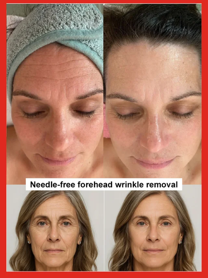 🔥BUY 1 GET 1 FREE🔥The Salmon Water Essence That Will SAVE Your Aging Face