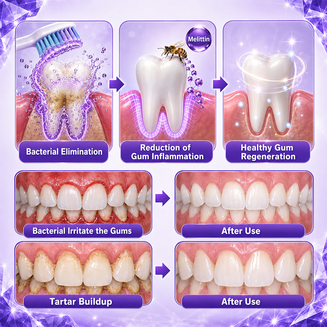 Gingivitis Periodontal Treatment Toothpaste
