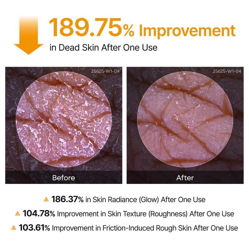 Shot Keratin Care Kojic Acid Turmeric Spray 200ML