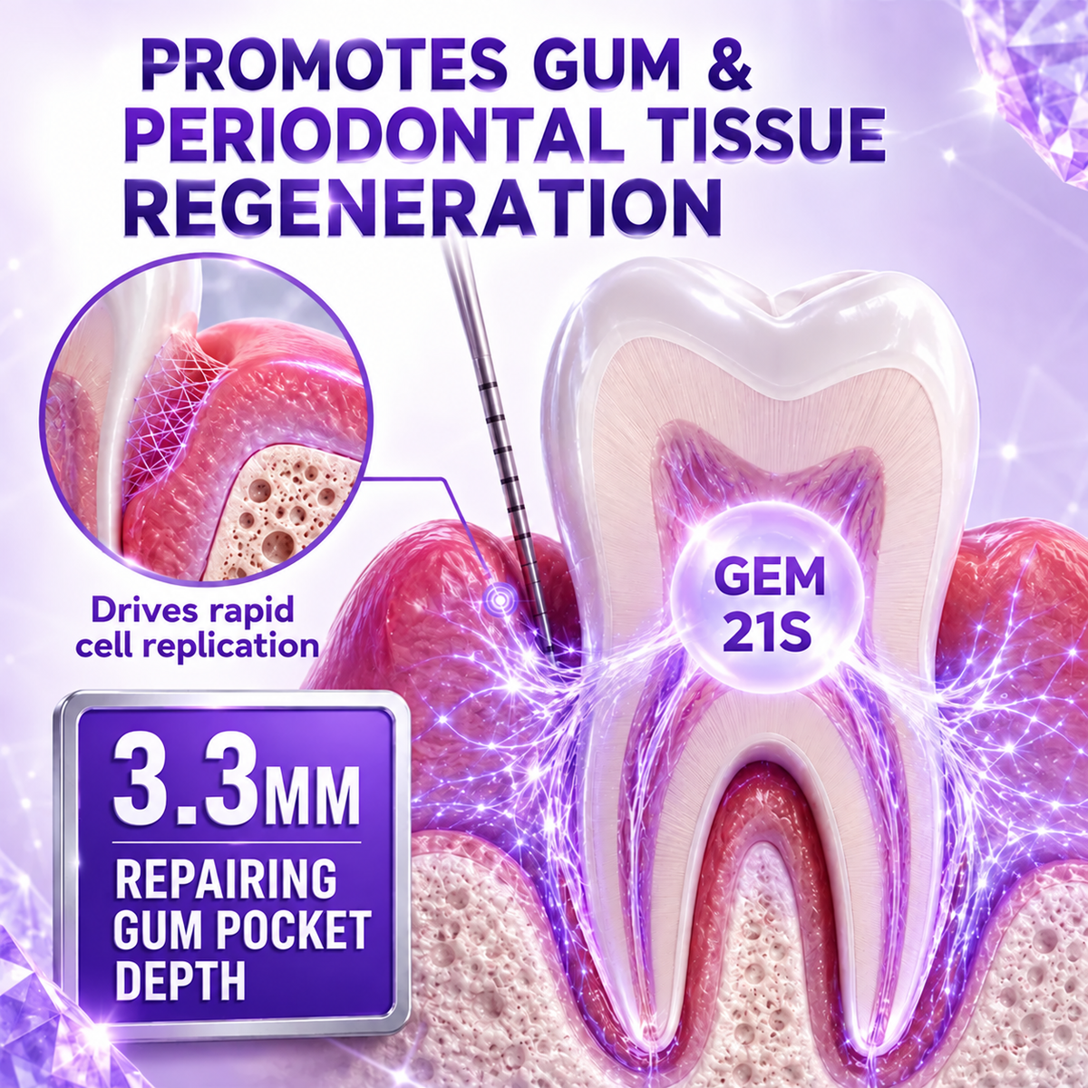Gingivitis Periodontal Treatment Toothpaste