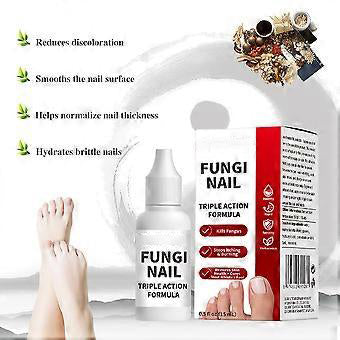Nail Care Renewal for Thick, Damaged & Discolored Nails, Plant Based Formula for Healthy Nail and Skin - 0.5 Fl Oz