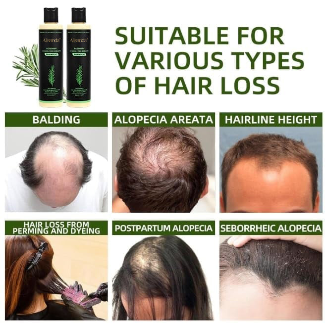 🔥LAST DAY 50% OFF - 🌿Organic Rosemary Hair Growth Shampoo