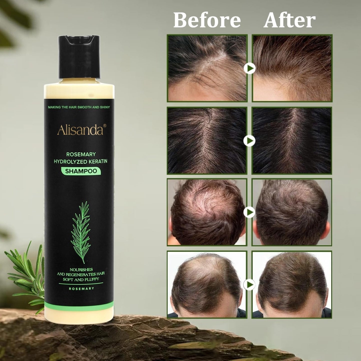 🔥LAST DAY 50% OFF - 🌿Organic Rosemary Hair Growth Shampoo