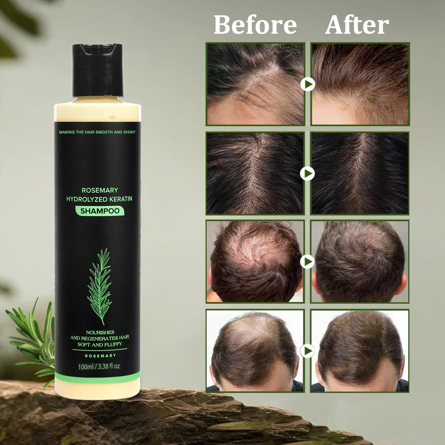 🔥LAST DAY 50% OFF - 🎅Organic Rosemary Hair Growth Shampoo