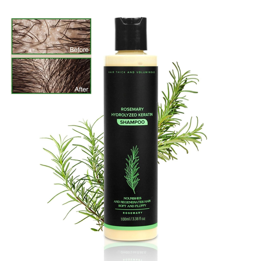🔥LAST DAY 50% OFF - 🎅Organic Rosemary Hair Growth Shampoo