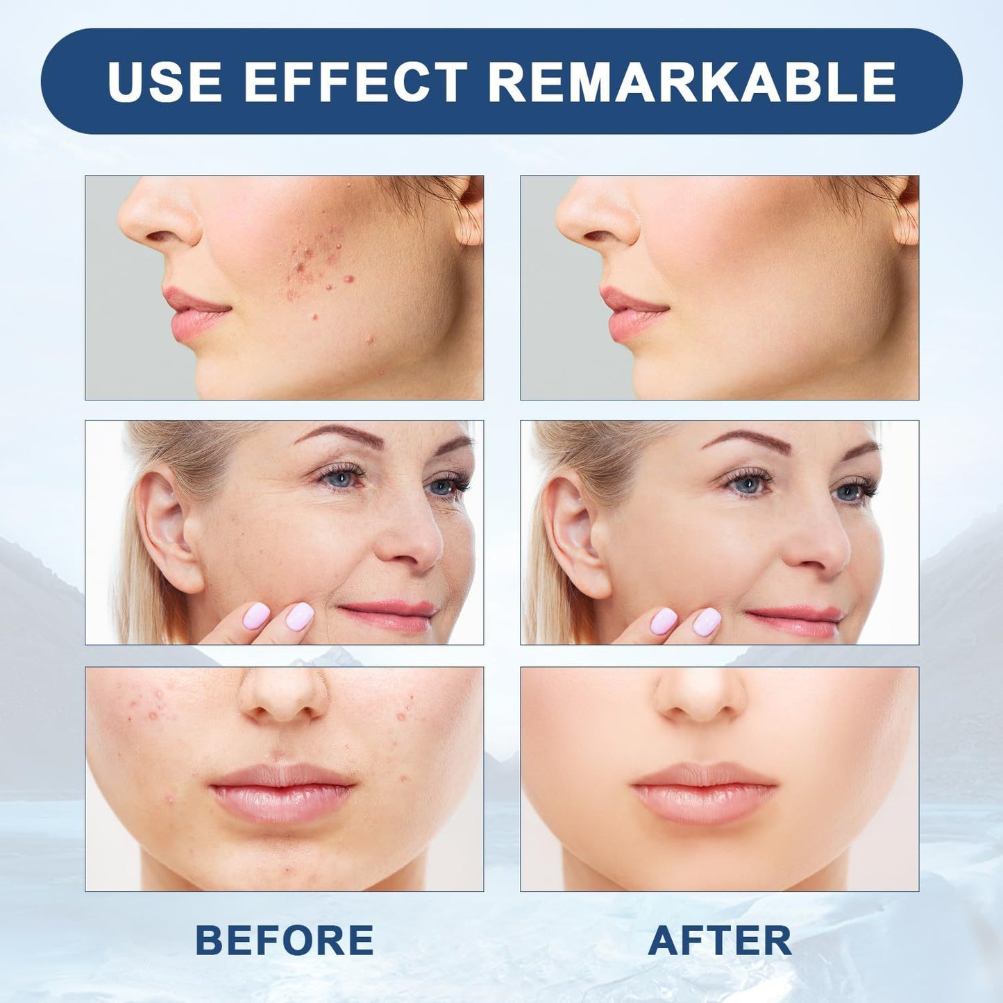 VICI WRINKLE REMOVAL OIL