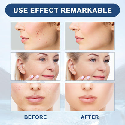 VICI WRINKLE REMOVAL OIL