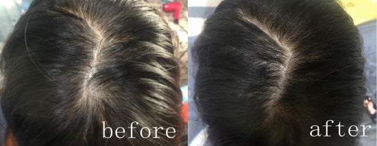 Hair Restoration Spray ( Reawaken Your Roots. Regrow Naturally. ✨ Clinically Proven Hair Regrowth Within 4 Weeks ✨)