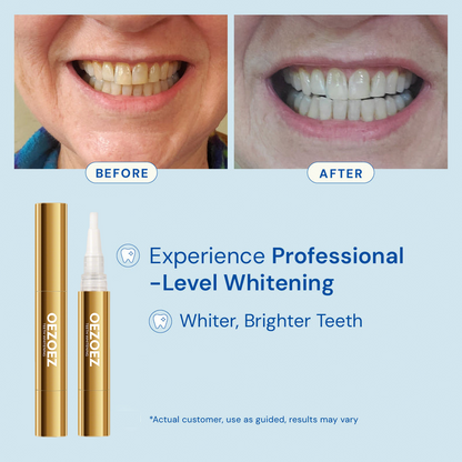 Extra-Strength Teeth Whitening Serum Pen + Dual-Peroxide Formula & Xylitol