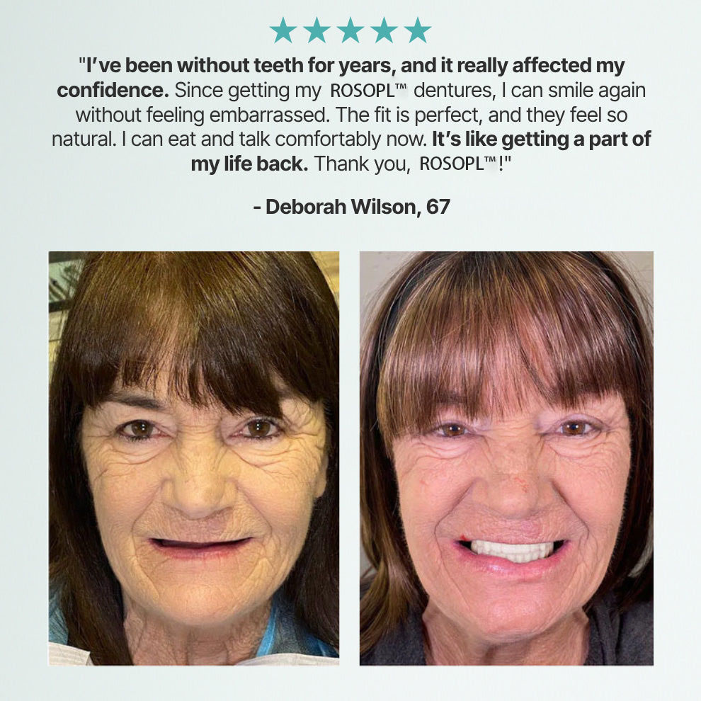 🔥Ends Today: 70% OFF! ROSOPLTM Custom-Fit Full Functional DenturesMake you more confident