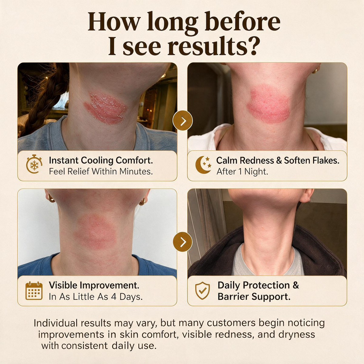 Advanced Psoriasis & Eczema Relief Cream